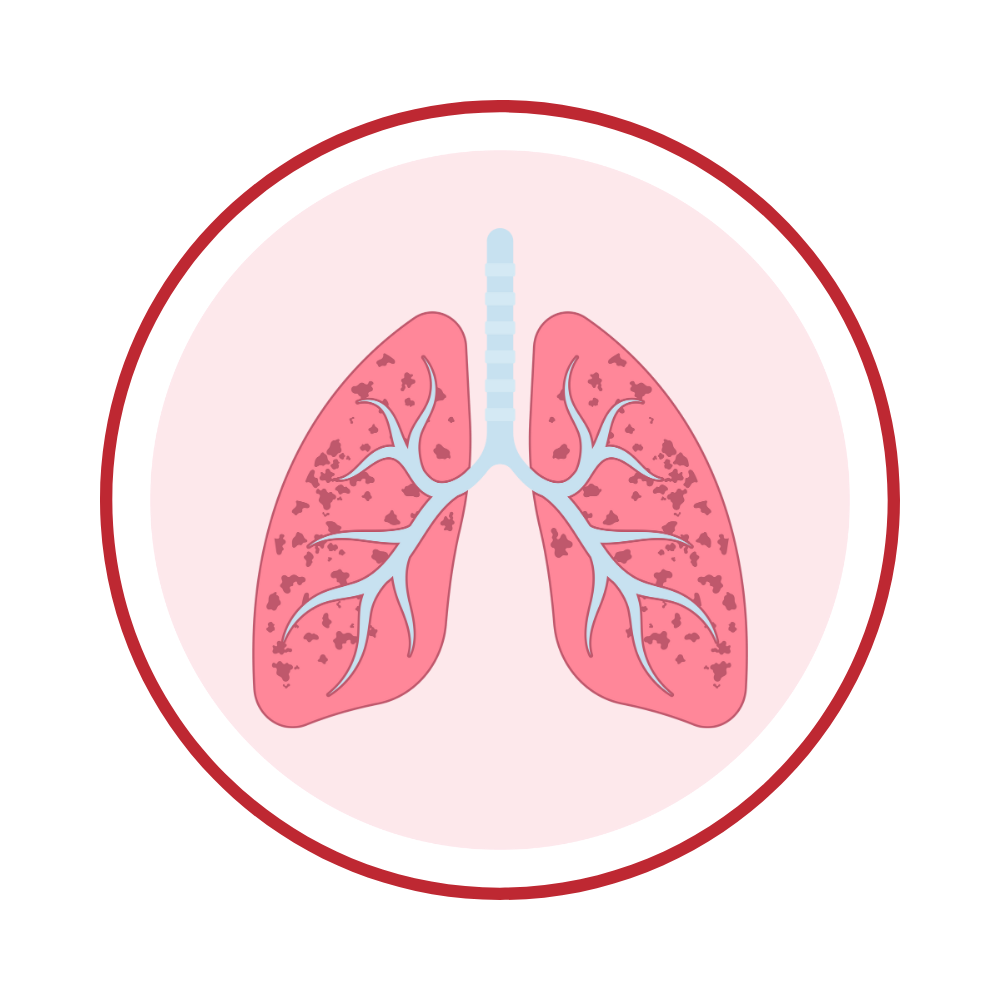 Respiratory